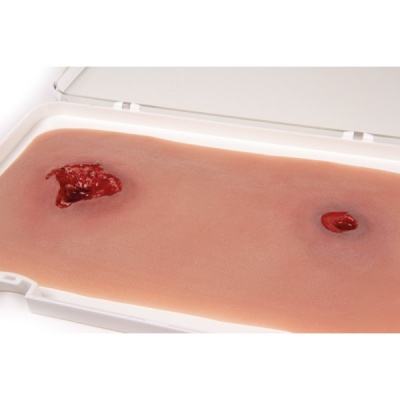 Erler Zimmer Wound Moulage Bullet Wound for the Leg with Bleeding Function